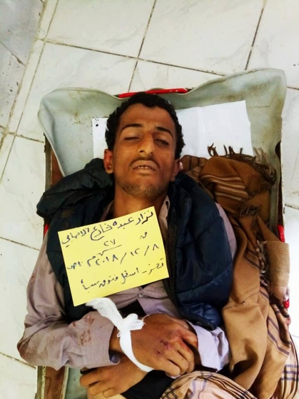 مقتل مدني برصاص قناص مليشيات الحوثي