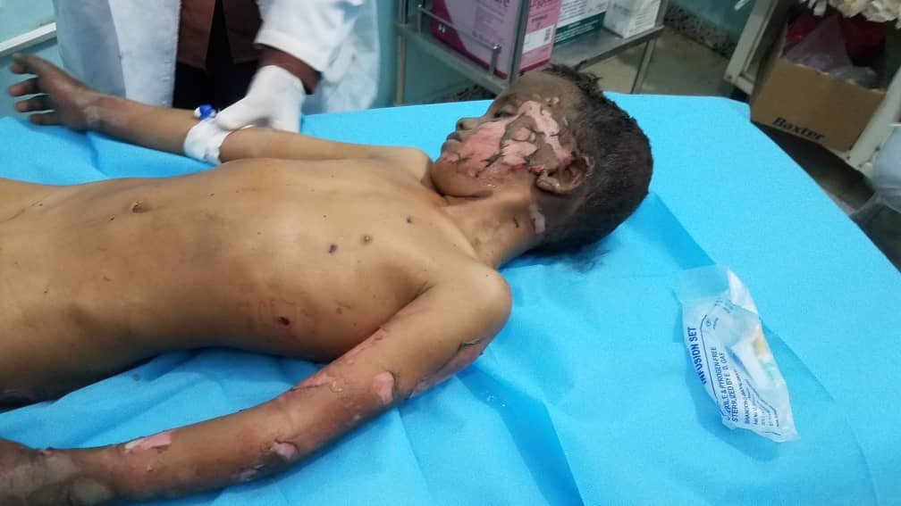 مقتل وجرح 5 مدنيين بينهم أطفال بقصف حوثي غربي الجوف