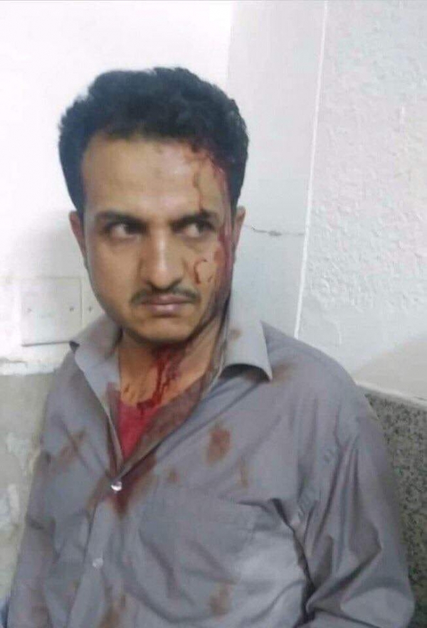 قيادي حوثي يعتدي على "ممرض" في هيئة مستشفى الثورة بـ"صنعاء"