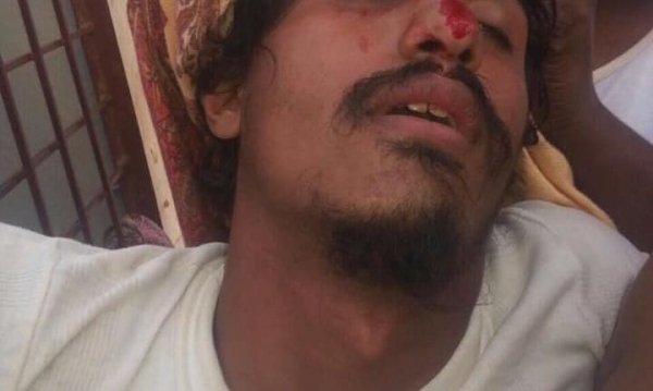 مسلحون تابعون للإمارات يعتقلون مجدداً يمنيا عقب انتشار صور تعذيبه