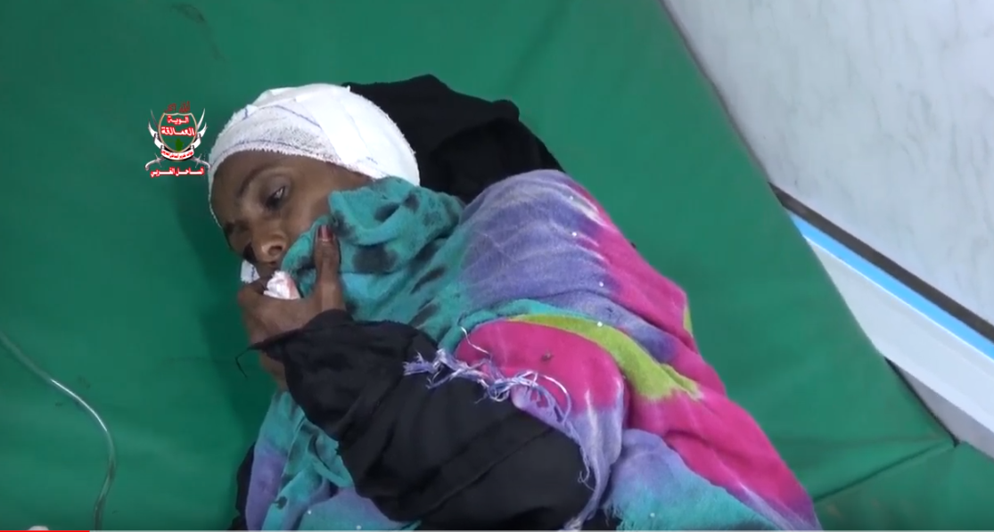 إصابة مسنة برصاص قناص حوثي في منطقة الجاح بيت الفقيه بالحديدة