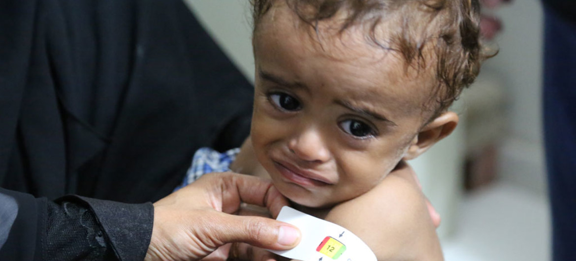 الصليب الأحمر يحذر من تجدد القتال في اليمن ويقول إن ذلك يهدد السكان بالأسوأ