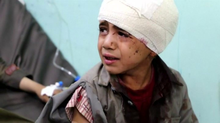 مقتل وجرح 27 طفلاً يمنياً خلال العشرة الأيام الماضية