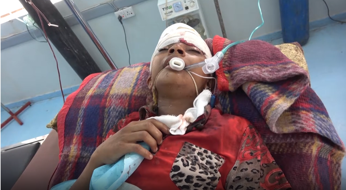 إصابة طفلين بقصف مدفعي شنته مليشيات الحوثي على منازل المواطنين في التحيتا (فيديو)