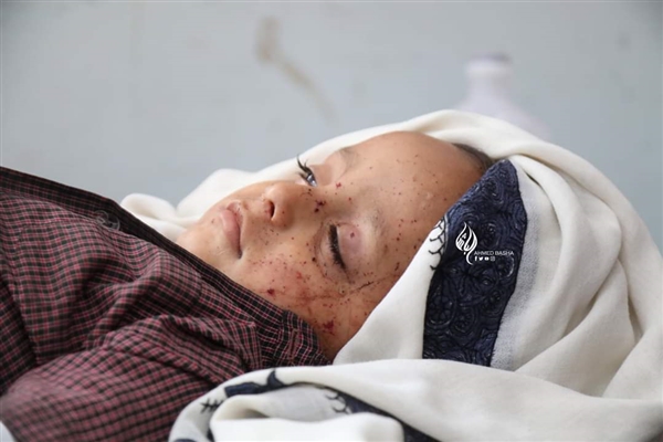 سياج تدين ارتكاب مليشيا الحوثي لمجازر مروعة بحق أطفال اليمن