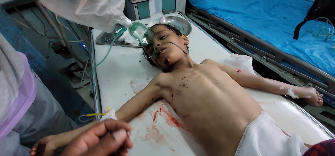 مارب .. استشهاد طفل واصابة خمسة اخرين نتيجة قصف لمليشيا الحوثي