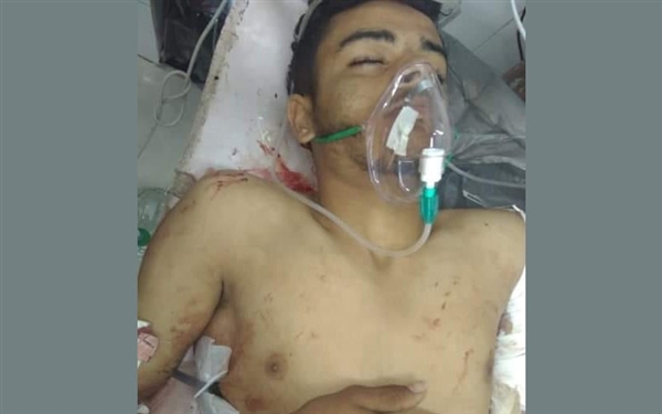 مقتل لاعب كرة قدم برصاص مليشيا الحوثي في إب