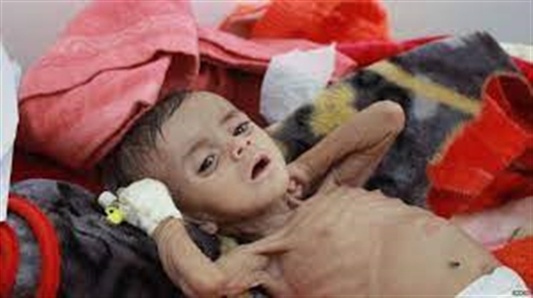 منظمة دولية ثلاث محافظات تحت حكم الحوثي  تظهر فيها المجاعة 