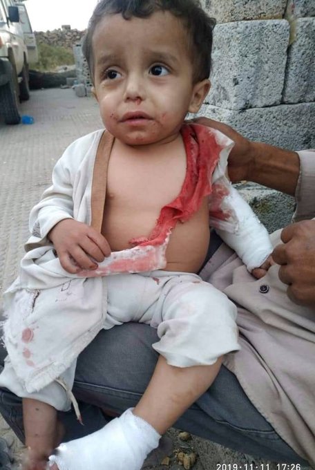 مقتل طفلة وإصابة أربعة آخرين بقصف للحوثيين على تعز