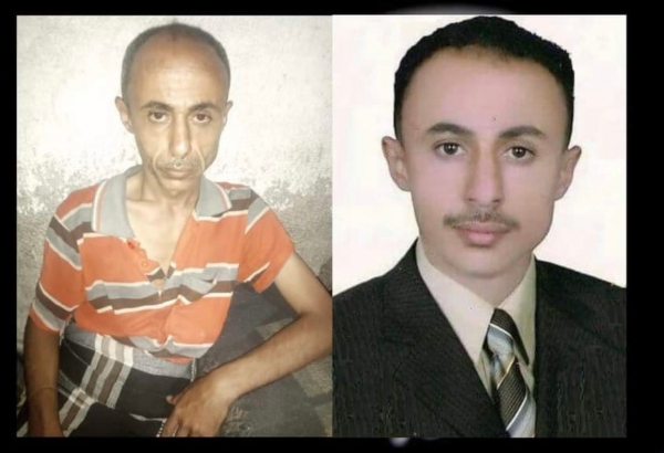 صورتان تلخصان المأساة.. هكذا يعذب الحوثيون الصحافيين المختطفين!