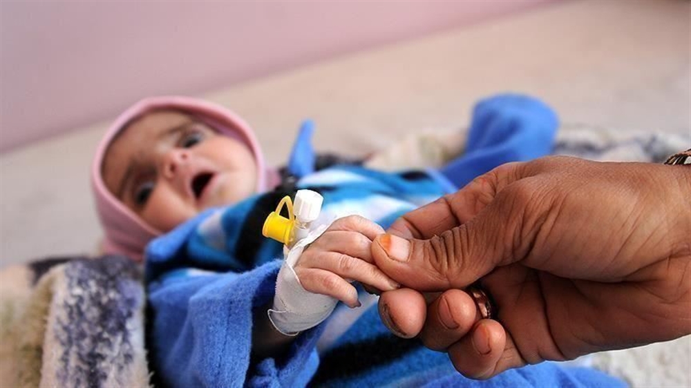 الصحة العالمية : 75 بالمئة من أطفال اليمن يعانون من سوء  التغذية المزمن