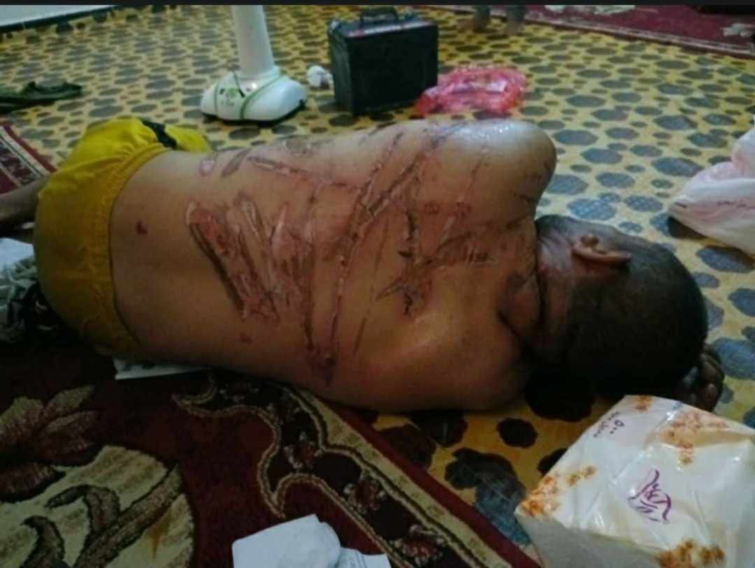 توفي بعد يوم واحد من إطلاقه ..أسرة "محمد مهدي" تنشر صوره وعليها أثار تعذيب وحشية بعد اختطافة من قبل قوات الإنتقالي 