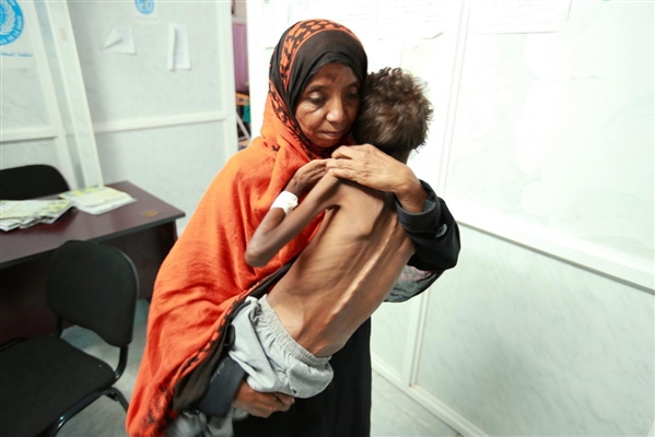 الأمم المتحدة تحذر: نصف سكان اليمن سيواجهون الجوع العام المقبل