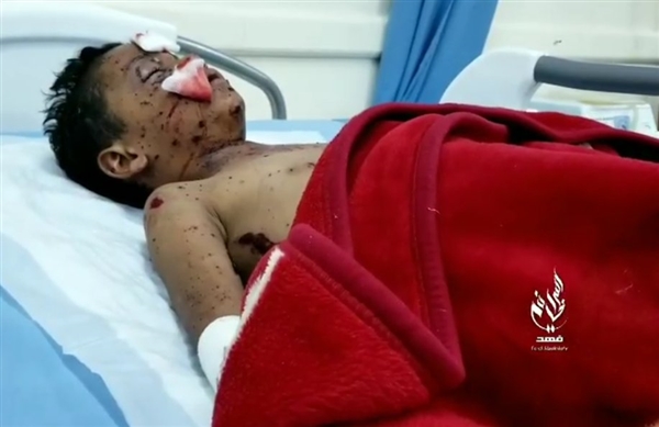 إصابة مواطن وطفلين بانفجار لغم حوثي شرقي تعز