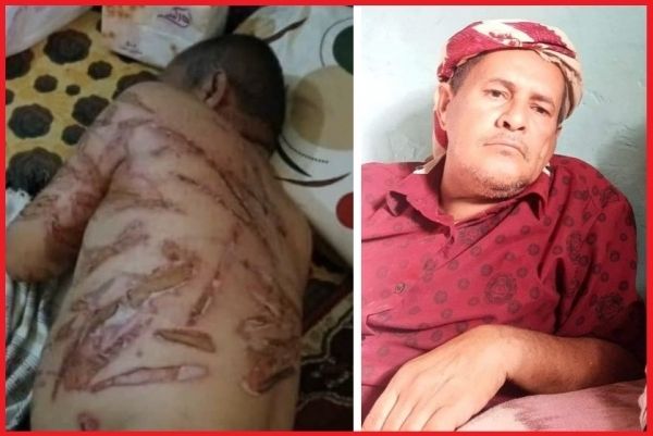  مطالبة حقوقية بفتح تحقيق محايد في حادثة اختطاف وتعذيب "مسن" في أبين