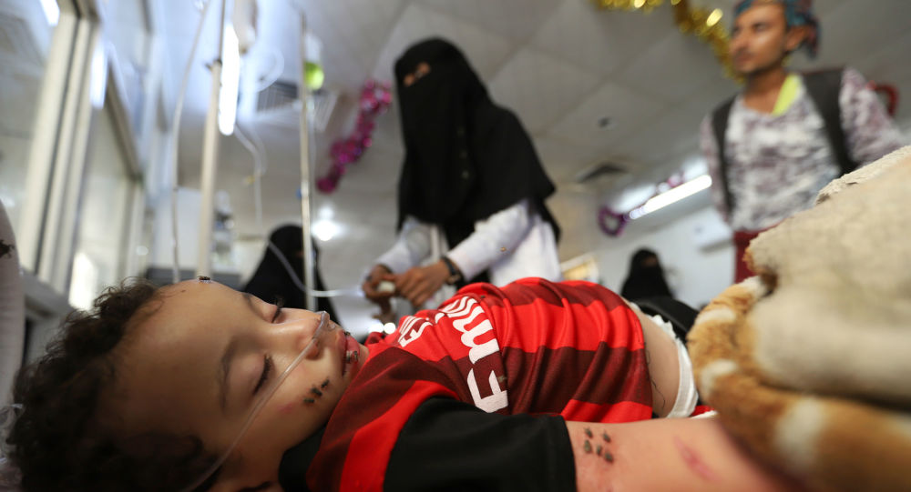 طفل من الحديدة يعاني بسبب الحرب- رويترز
