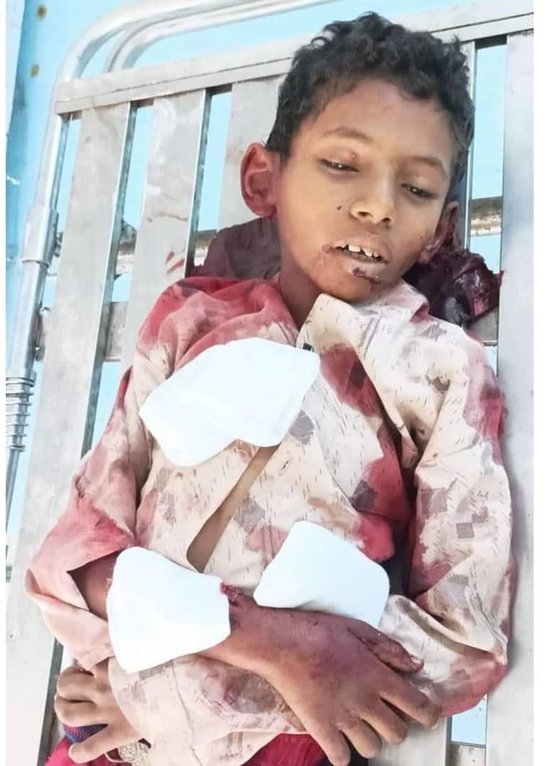مقتل طفل بقصف طائرة بدون طيار حوثية في الحديدة