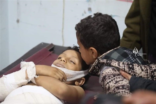 تعز .. إصابة 3 أطفال بقذيفة أطلقتها الميليشيات الحوثية على حي سكني 