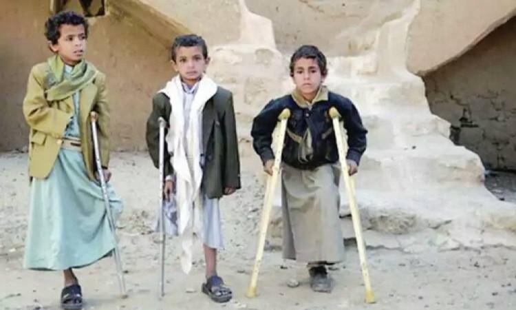 تقرير دولي: ارتفاع ضحايا الألغام من الأطفال في اليمن ثمانية أضعاف في 5 سنوات
