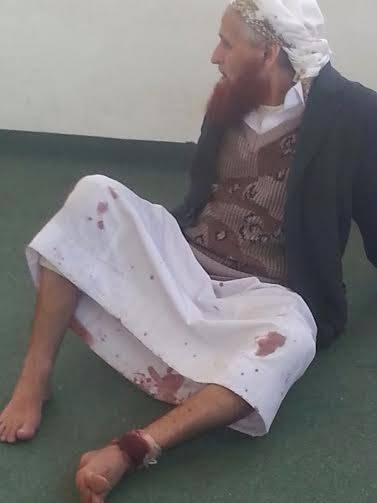 مليشيا الحوثي تفرج عن إمام مسجد بعد أيام من اختطافه والاعتداء عليه بذمار (صورة)