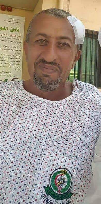 إصابة شقيق الشهيد القشيبي مستشار رئيس هيئة الأركان العامة خلال المعارك بمدينة ميدي بحجة (صورة)