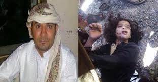 محكمة ذمار تؤجل قضية الطفلة مئاب حتى رد محامي المتهم