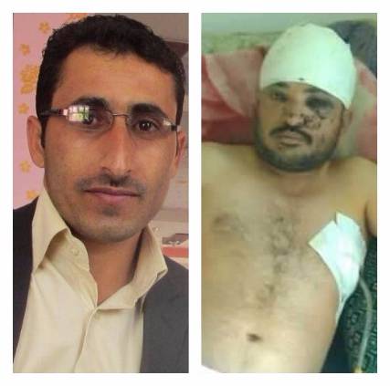 منظمات صحفية وحقوقية بذمار تدين،اختطاف الصحفيين المنيفي والعيسي وتطالب الحوثيين بالافراج الفوري وغير المشروط عنهما