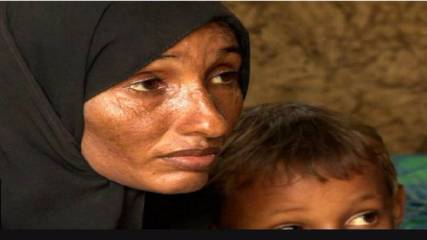 الحرب في اليمن تُعمق معاناة النساء وإعلاميات يدشن حملة للسلام
