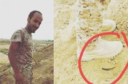 جندي سعودي يدوس على لغم أرضي بقدمه وينجو من الموت بأعجوبه 