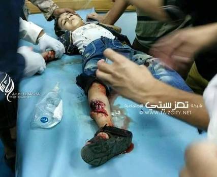 مليشيا صالح والحوثي تقتل 5 من المدنيين وتحشد آليات وتعزيزات على مداخل تعز