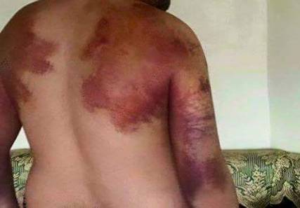تلفيق تهمة الانضمام لـ«داعش» ضد 1200 معتقل في صنعاء