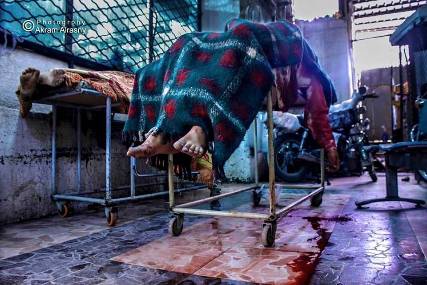 مليشيا الحوثي تواصل قصف تعز و استشهاد 3 مدنيين وجرح 19 آخرين